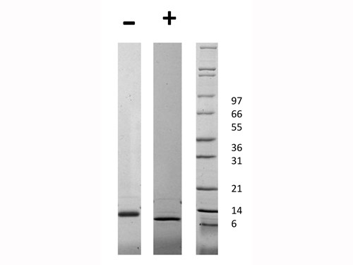 Connective Tissue Growth Factor