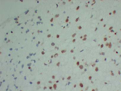 Anti-SMARCB1 / BAF47