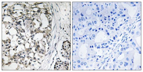 Anti-PEX14