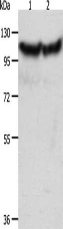 Anti-ACTN3