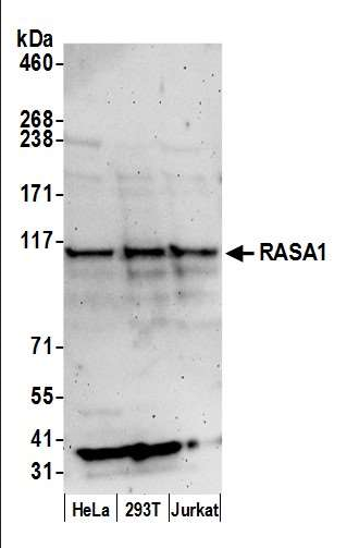 Anti-RASA1
