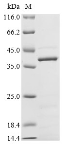 Muscarinic acetylcholine receptor M5 (CHRM5), partial, human, recombinant