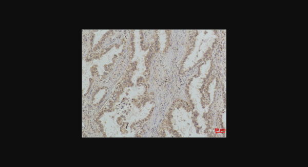 Anti-P53(Mono Methyl Lys370), monoclonal