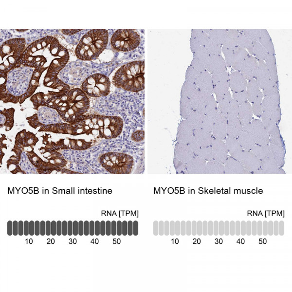 Anti-MYO5B