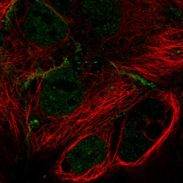 Anti-MPP7