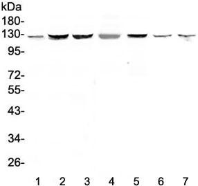 Anti-SMC6