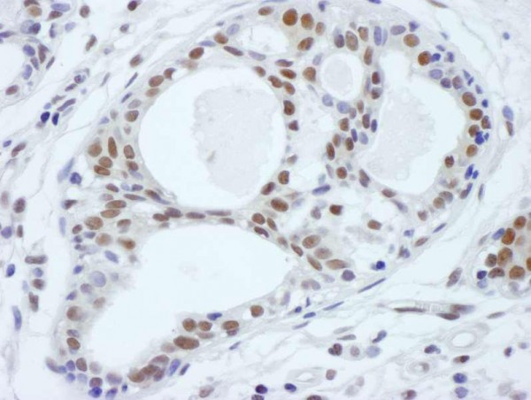 Anti-ASH2 (IHC)