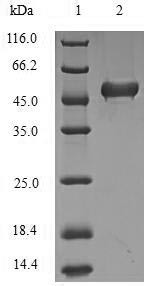 Lys-63-specific deubiquitinase BRCC36 (BRCC3), human, recombinant