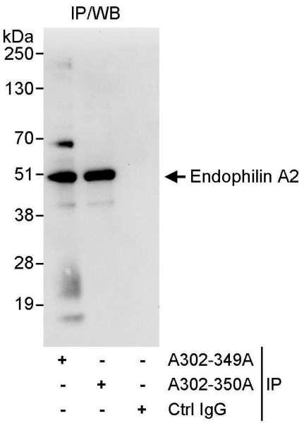 Anti-Endophilin A2