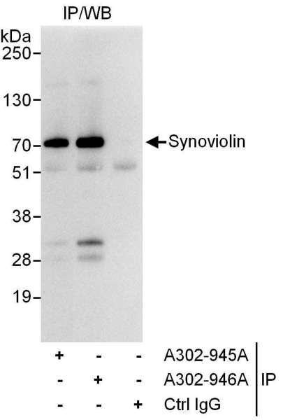 Anti-Synoviolin