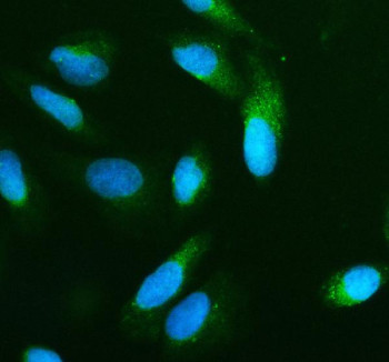 Anti-BNIP3L / NIX / BCL2/adenovirus E1B 19 kDa-interacting protein 3-like