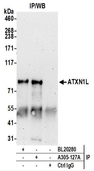 Anti-ATXN1L