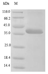 Minor capsid protein VP2, BK polyomavirus, recombinant