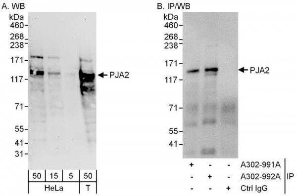 Anti-PJA2
