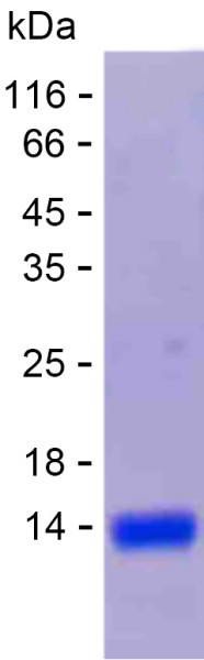 Recombinant Human CRAT Protein