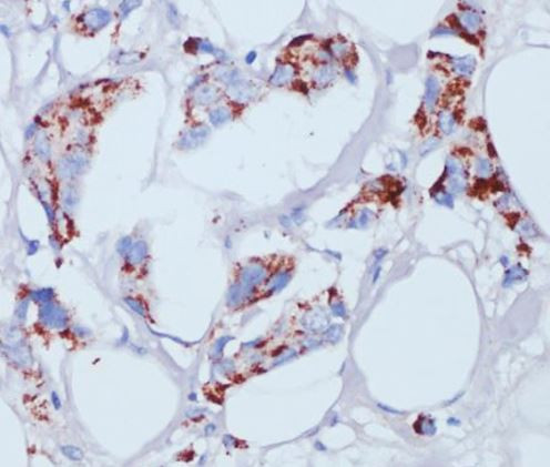 Anti-ACSL3