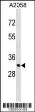 Anti-MGLL, NT (MGLL, Monoglyceride lipase, HU-K5, Lysophospholipase homolog, Lysophospholipase-like,