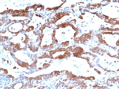 Anti-FAK (Focal adhesion kinase 1), Rabbit Monoclonal (RM472)