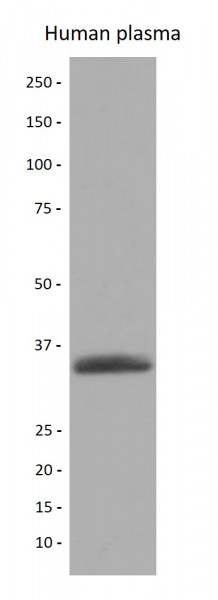 Anti-alpha 1 microglobulin