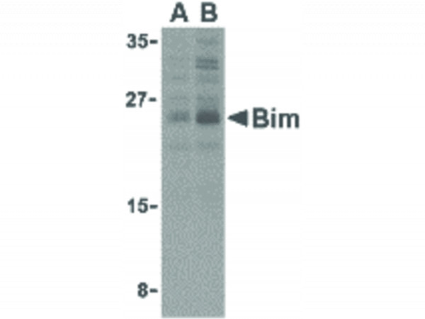 Anti-Bim