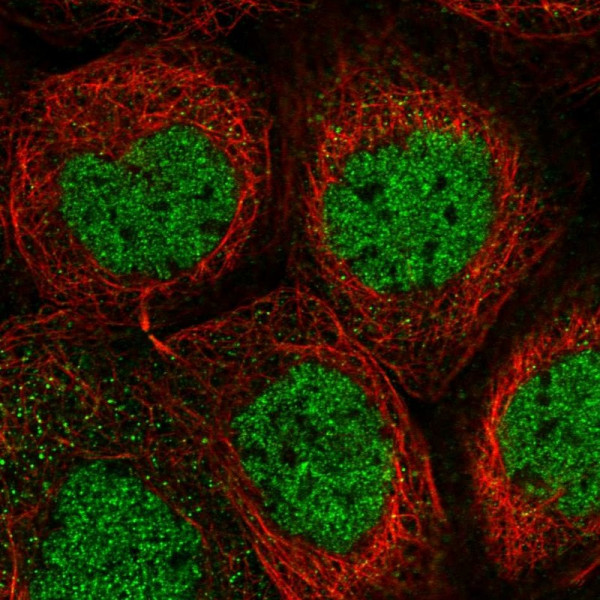 Anti-PSMA1