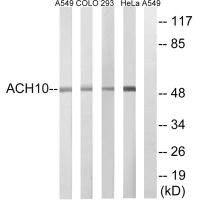 Anti-CHRNA10