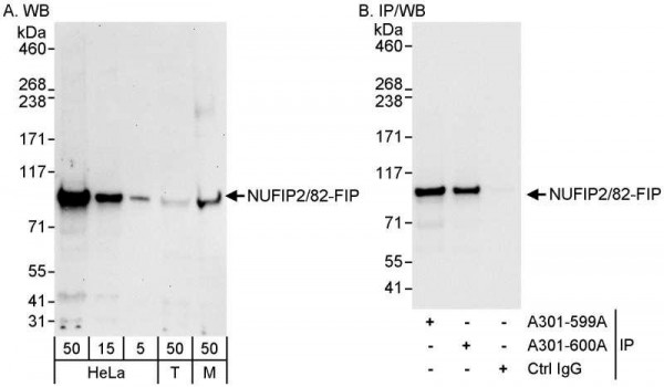 Anti-NUFIP2/82-FIP