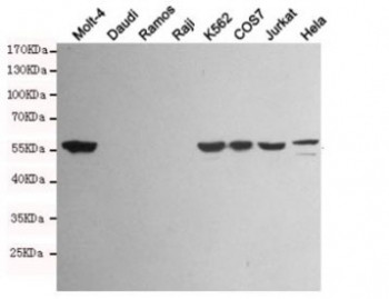Anti-Vimentin, clone 4F8-A5-H5