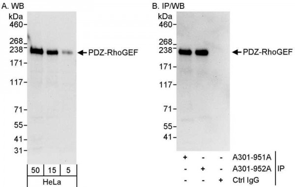 Anti-PDZ-RhoGEF