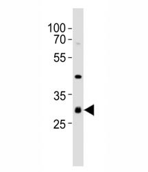 Anti-CDK5