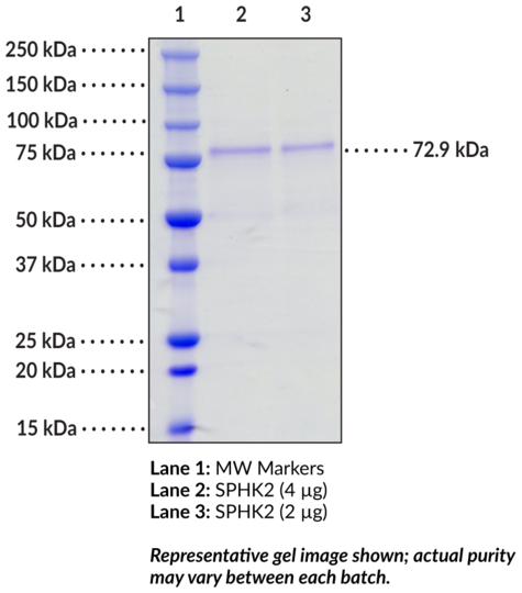 Sphingosine Kinase 2 (human, recombinant)