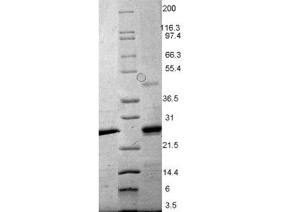 Epstein Barr Virus Induced 3 (EBI-3), mouse recombinant (rmEBI-3)