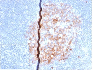 Anti-CD86 (Dendritic Cells Maturation Marker), recombinant antibody, clone rC86/6872