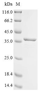 LysM and putative peptidoglycan-binding domain-containing protein 3 (Lysmd3), partial, mouse, recomb