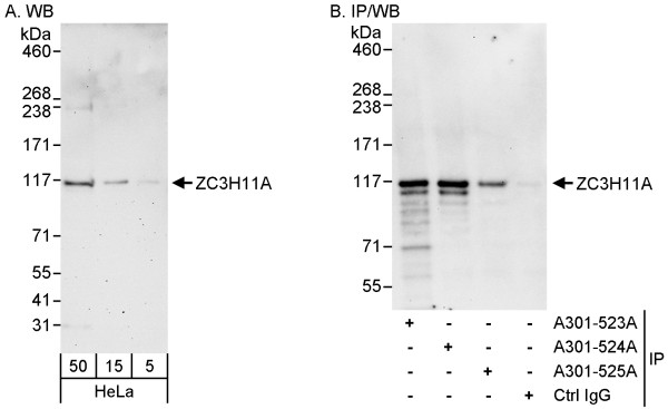 Anti-ZC3H11A