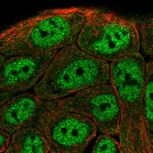 Anti-TNIP1