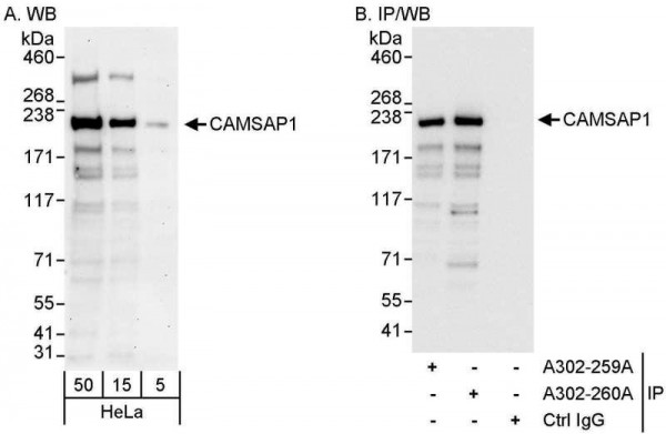 Anti-CAMSAP1