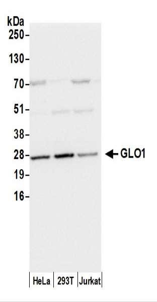 Anti-GLO1/Glyoxalase I