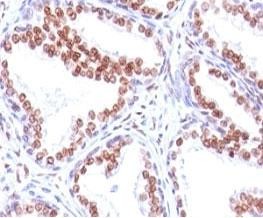 Anti-Androgen Receptor, clone SPM335