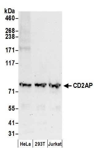 Anti-CD2AP