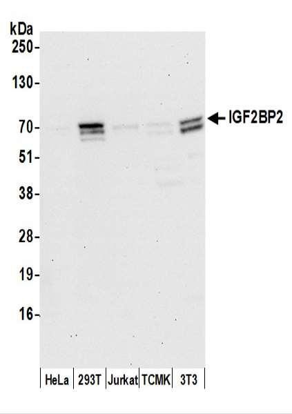 Anti-IGF2BP2 Monoclonal