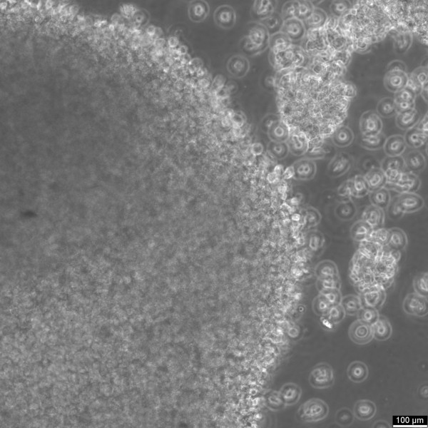 PLH Cells