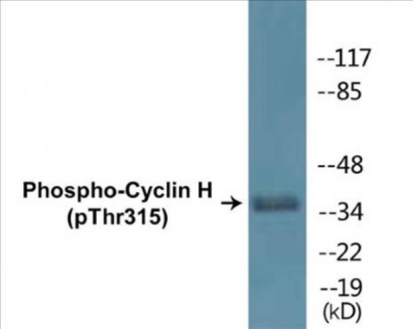 Cyclin H (Phospho-Thr315) Colorimetric Cell-Based ELISA Kit