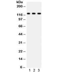 Anti-PLD1