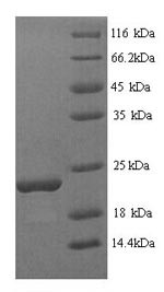 Stress-induced protein SAM22 (PR-10), Glycine max, recombinant