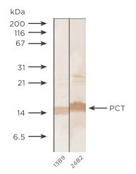 Anti-Calcitonin, clone 13B9