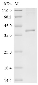 Ferric oxidoreductase domain-containing protein (STEAP1), Macaca mulatta, recombinant