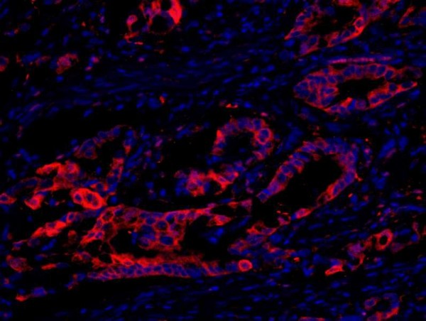 Anti-eEF2 Kinase (IHC)