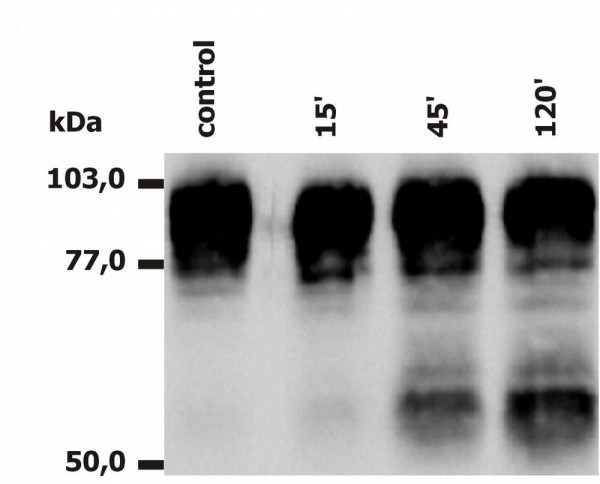 Anti-CD18, clone MEM-148