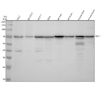 Anti-HBP1 / HMG-box transcription factor 1